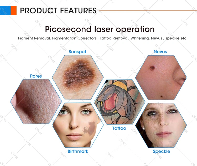 1800W Pigment Removal Portable Picosecond Laser Pico Laser Tattoo Machine Handle